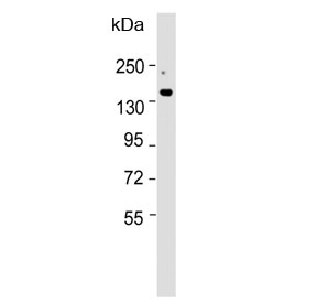 Western blot testing of mouse liver lysate with ATP7B antibody. Expected molecular weight: 140-157 kDa.