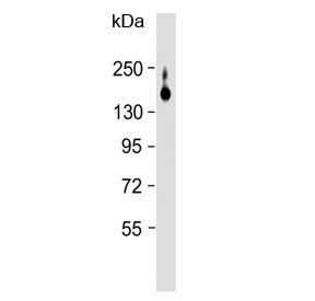 Western blot testing of rat liver lysate with ATP7B antibody. Expected molecular weight: 140-157 kDa.