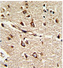 IHC testing of FFPE human brain tissue with PDIA6 antibody. HIER: steam section in pH6 citrate buffer for 20 min and allow to cool prior to staining.