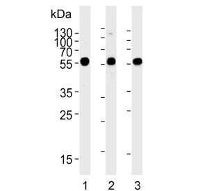 Western blot testing of 1) Jurkat, 2) human Ramos and 3) rat C6 cell lysate with CALR antibody. Expected molecular weight: 46-55 kDa.