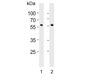 Western blot testing of mouse 1) lung and 2) ovary lysate with RYK antibody. Predicted molecular weight ~68 kDa.