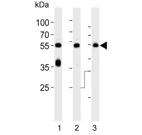 Western blot testing of 1) human brain, 2) mouse brain and 3) rat brain lysate with PACSIN1 antibody. Predicted molecular weight ~50 kDa.