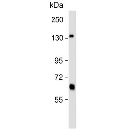 Western blot testing of human 293 cell lysate with Glutaminase antibody. Predicted molecular weight: 65-73 kDa. 