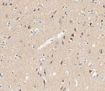 IHC testing of FFPE human brain tissue with Glutaminase antibody. HIER: steam section in pH6 citrate buffer for 20 min and allow to cool prior to staining.