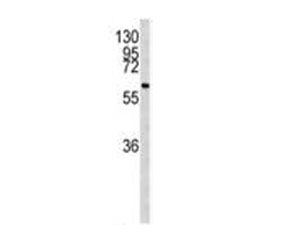Western blot testing of human 293 cell lysate with CDC73 antibody. Predicted molecular weight ~61 kDa.