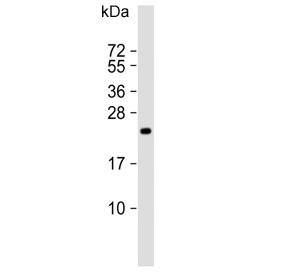 Western blot testing of human HT-1080 cell lysate with TIMP2 antibody. Predicted molecular weight ~24 kDa.