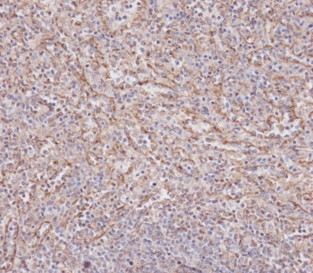 IHC testing of FFPE human spleen tissue with IFITM3 antibody. HIER: steam section in pH6 citrate buffer for 20 min and allow to cool prior to staining.