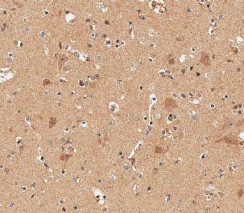 IHC testing of FFPE human brain tissue with DLL3 antibody. HIER: steam section in pH6 citrate buffer for 20 min and allow to cool prior to staining.