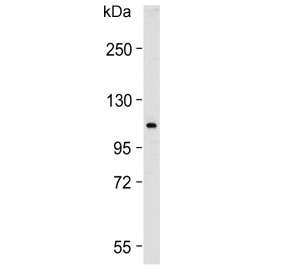 Western blot testing of human placenta lysate with GAA antibody. Predicted molecular weight ~105 kDa.