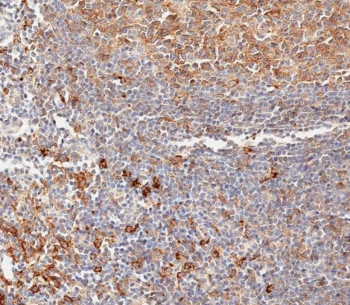 IHC testing of FFPE human lymph node tissue with HLA-DPB1 antibody.