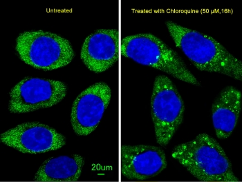 Immunofluorescent staining of fixed and permeabilized human U-251 cells with ATG16L1 antibody (green) and DAPI nuclear stain (blue).