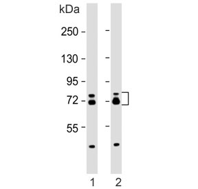 Western blot testing of human 1) A431 and 2) MCF7 cell lysates with ESRP1 antibody. Predicted molecular weight: 68-76 kDa (multiple isoforms).