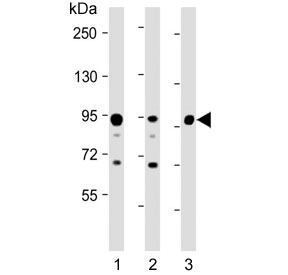 VIL1 Antibody for WB. Western blot analysis of Villin-1 (VIL1) protein expression in epithelial-derived lysates using a rabbit polyclonal antibody. Lane 1: human HT-29 lysate, Lane 2: human SW480 lysate, Lane 3: mouse colon lysate. A band is detected at approximately 93 kDa, consistent with the predicted molecular weight of Villin-1 / VIL1. Additional lower molecular weight bands are observed in some lanes, which may reflect proteolytic processing or partial degradation products commonly seen in cytoskeletal proteins under certain lysis conditions. The strong signal in colon-derived samples aligns with the known enrichment of Villin in intestinal epithelium, supporting its use as a robust western blot marker for epithelial brush border structure and differentiation.