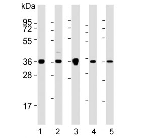 Western blot testing of 1) human HeLa, 2) human MCF7, 3) mouse NIH 3T3, 4) human SH-SY5Y and 5) human SK-BR-3 cell lysate with Annexin A2. Predicted molecular weight ~38 kDa.