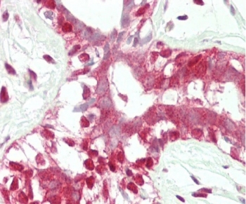 IHC testing of FFPE human breast tissue with ADH5 antibody. HIER: steam section in pH6 citrate buffer for 20 min and allow to cool prior to staining.