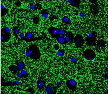Synaptophysin Antibody for Immunofluorescence. Immunofluorescence staining of human brain tissue demonstrates dense punctate cytoplasmic fluorescence corresponding to Synaptophysin (SYP) localization in presynaptic vesicles throughout neuronal neuropil. Green fluorescent signal highlights abundant synaptic vesicle clusters characteristic of neuronal synapses, while DAPI counterstain (blue) marks cell nuclei. The staining pattern reflects the high synaptic density typical of brain tissue, where Synaptophysin-positive vesicles are distributed along neuronal processes and presynaptic terminals. This rabbit polyclonal Synaptophysin antibody was used to visualize synaptic vesicle protein localization in neuronal cells by fluorescence microscopy.