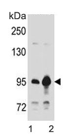 Catenin Beta Antibody WB. Western blot testing of human 1) 293 and 2) T-47D cell lysate with Catenin Beta antibody. Predicted molecular weight ~85 kDa, but routinely observed at 90-95 kDa.