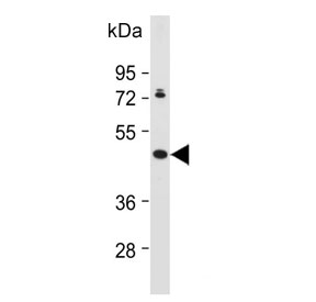 Western blot testing of human MDA-MB-453 cell lysate with GFRAL antibody. Predicted molecular weight ~45 kDa.
