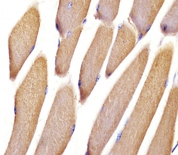 Vinculin Antibody Mouse Muscle IHC. Immunohistochemistry testing of FFPE mouse skeletal muscle tissue with Vinculin antibody. HIER: steam section in pH6 citrate buffer for 20 min and allow to cool prior to staining.