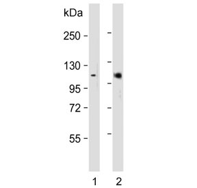 Western blot testing of 1) mouse eyeball and 2) rat eyeball lysate with Retinoblastoma antibody. Predicted molecular weight ~110 kDa.