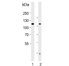 Western blot testing of human 1) placenta and 2) plasma lysate with Autotaxin antibody. Expected molecular weight: 99-125 kDa depending on glycosylation level.