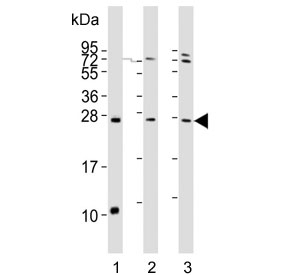 Western blot testing of 1) mouse lung, 2) human liver and 3) human HeLa lysate with Sclerostin antibody. Predicted molecular weight ~24 kDa.