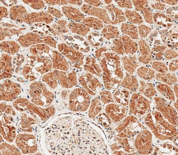 IHC testing of FFPE human kidney tissue with Sclerostin antibody. HIER: steam section in pH9 EDTA for 20 min and allow to cool prior to staining.