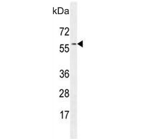 Western blot testing of hamster CHO cell lysate with GTPBP2 antibody. Predicted molecular weight 66 kDa with a possible ~46 kDa mutation product.