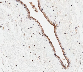IHC testing of FFPE human breast tissue with CEPT1 antibody. HIER: steam section in pH9 EDTA for 20 min and allow to cool prior to staining.