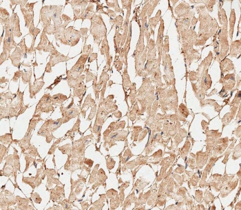 IHC testing of FFPE human heart tissue with COL5A1 antibody. HIER: steam section in pH9 EDTA for 20 min and allow to cool prior to staining.