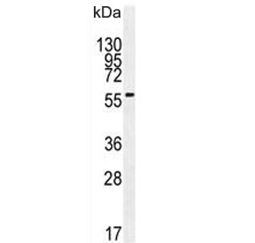 Western blot testing of mouse liver lysate with DHCR7 antibody. Predicted molecular weight ~54 kDa.