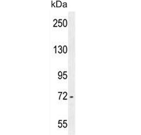 Western blot testing of mouse cerebellum lysate with ZBTB24 antibody. Predicted molecular weight ~78 kDa.