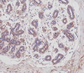 IHC testing of FFPE human breast tissue with POSTN antibody. HIER: steam section in pH9 EDTA for 20 min and allow to cool prior to staining.