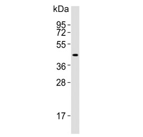 IDO2 Antibody Human Kidney WB. Western blot testing of human kidney lysate with IDO2 antibody. Predicted molecular weight ~47 kDa.