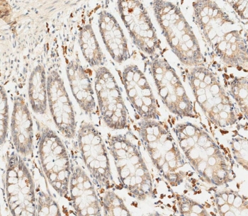 IHC testing of FFPE human colon tissue with SFRP5 antibody. HIER: steam section in pH9 EDTA for 20 min and allow to cool prior to staining.