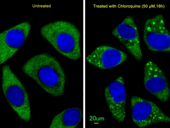 Immunofluorescent staining of treated and untreated human U-251 cells with ATG7 antibody (green) and DAPI nuclear stain (blue).