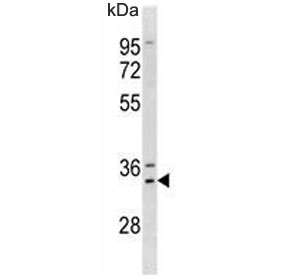 Western blot testing of human A375 lysate with MSX1 antibody. Predicted molecular weight ~31 kDa.