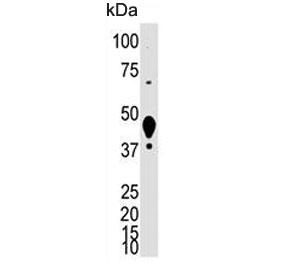 Western blot testing of mouse liver lysate with LYVE1 antibody. Expected molecular weight: 35-65 kDa depending on glycosylation level.