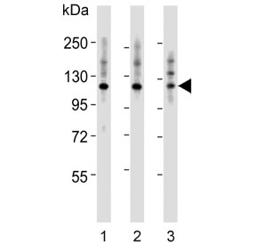 Western blot testing of human 1) HeLa, 2) A431 and 3) Jurkat cell lysate with Integrin alpha 7 antibody. Predicted molecular weight ~129 kDa.