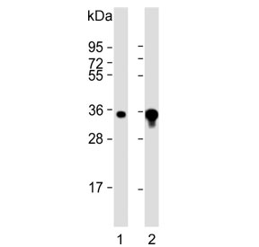AKR1B1 Antibody A549 and A431 WB. Western blot testing of human 1) A431 and 2) A549 cell lysate with AKR1B1 antibody. Predicted molecular weight ~36 kDa.