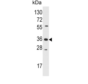 AKR1B1 Antibody Jurkat WB. Western blot testing of human Jurkat cell lysate with AKR1B1 antibody. Predicted molecular weight ~36 kDa.
