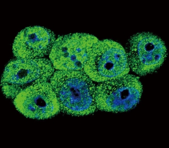 AKR1B1 Antibody HEK293 IF. Immunofluorescent staining of human HEK293 cells with AKR1B1 antibody (green) and DAPI nuclear stain (blue).