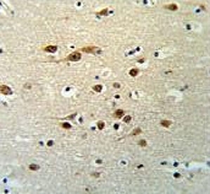 IHC testing of FFPE human brain tissue with TOX-3 antibody. HIER: steam section in pH6 citrate buffer for 20 min and allow to cool prior to staining.