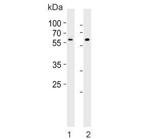 Western blot testing of 1) human HepG2 and 2) mouse brain lysate with TENT2 antibody. Predicted molecular weight ~56 kDa.