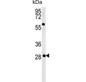Western blot testing of mouse testis lysate with GSTO2 antibody. Predicted molecular weight ~28 kDa.