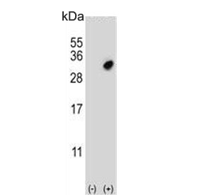 Western blot testing of 1) non-transfected and 2) transfected 293 cell lysate with GSTO2 antibody.