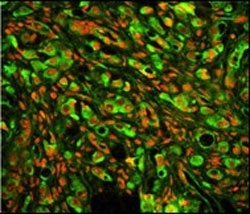Immunofluorescent staining of human prostate carcinoma cells with PTP4A2 antibody (green) PI (red).