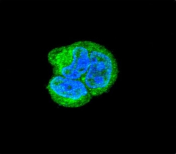 Immunofluorescent staining of fixed and permeabilized human MCF7 cells with Aspartoacylase antibody (green) and DAPI nuclear stain (blue).