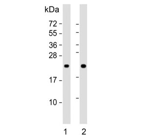 Western blot testing of human 1) Jukat and 2) Raji cell lysate with CBFB antibody. Predicted molecular weight ~22 kDa.