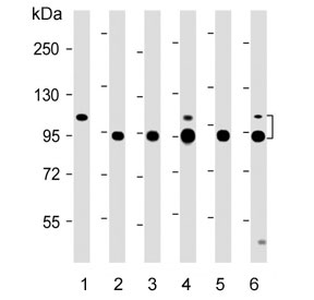 Western blot testing of 1) human skeletal muscle, 2) mouse ATDC5, 3) HUVEC, 4) human Jurkat, 5) human MG-63 and 6) human U-2 OS lysate with TSP5 antibody. Expected molecular weight: 83-100 kDa depending on glycosylation level.